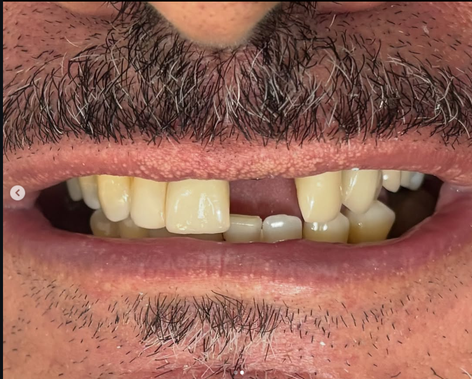 Registro clínico de um sorriso em tratamento